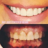 Implant Center Of Miami image 2
