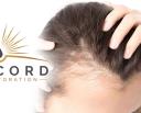 Concord Hair Restoration logo