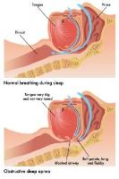 Encino Center for Sleep & TMJ Disorders image 4