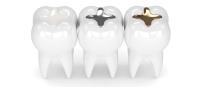 Premier Dental Care image 2