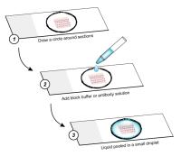 IF Protocol - Stick Section image 1