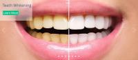 Apex Dental P.A. image 9