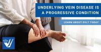 USA Vein Clinics image 37