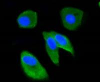 anti ubiquitin antibody image 1