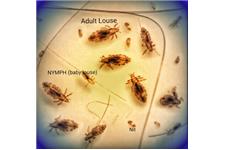 The Louse Girl Head Lice Removal Service image 4