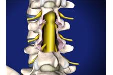 Spine Care of San Antonio, Michael S McKee, MD image 2