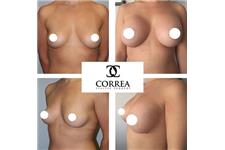 Correa Plastic Surgery image 3