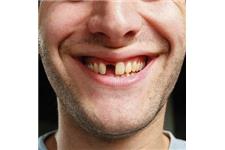 Mesa Dental image 5