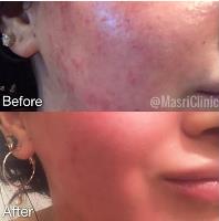 Masri Clinic For Laser and Cosmetic Surgery image 1