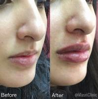 Masri Clinic For Laser and Cosmetic Surgery image 12