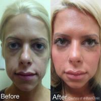 Masri Clinic For Laser and Cosmetic Surgery image 7