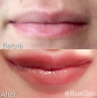 Masri Clinic For Laser and Cosmetic Surgery image 9