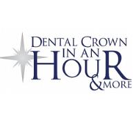 Dental Crown in an Hour: Bonita Beach image 1