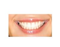 Hartzdale Dental Care image 2