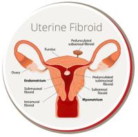 USA Fibroid Centers image 5