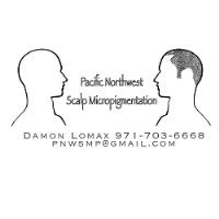 Pacific Northwest Scalp Micropigmentation image 4