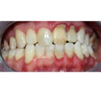 Dhillon Dental Care image 2
