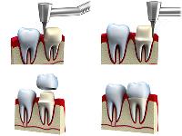 Edgewater Dental - Family Dentist Nampa image 12