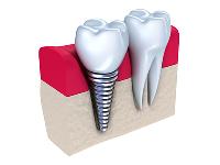 Edgewater Dental - Family Dentist Nampa image 8