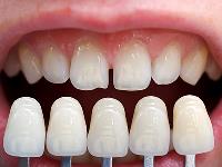 Edgewater Dental - Family Dentist Nampa image 2