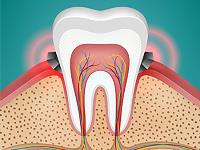 Edgewater Dental - Family Dentist Nampa image 5