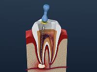 Edgewater Dental - Family Dentist Nampa image 3