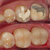 Seminole Dentistry image 4