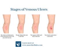 USA Vein Clinics image 29