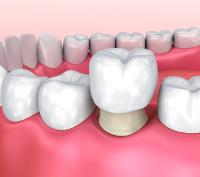 Dutch Creek Dental image 1