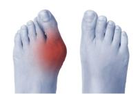 Foot Pain Therapy image 2