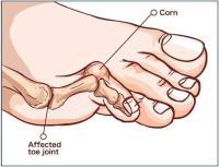 Foot Pain Therapy image 11