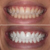 Open Late Dentistry and Orthodontics image 13