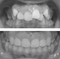 Fusion Orthodontics and Children's Dentistry image 5