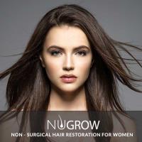 NuGrow Hair Restoration - Turkey Lake image 3