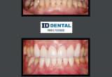 ID Dental Implant and Dental Care 아이디 치과 엘에이 image 10