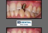 ID Dental Implant and Dental Care 아이디 치과 엘에이 image 11