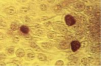 Chlamydia Trachomatis Antigens image 1