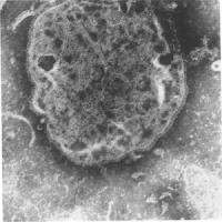 Measles Virus Antigens image 1