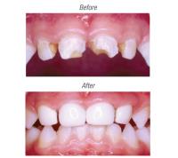 Montebello Childrens Dentistry image 5