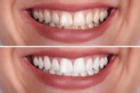AvA Orthodontics & Invisalign image 9