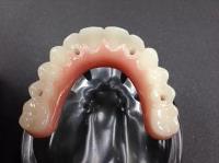 Value Dental Care image 4