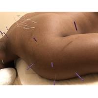 Morningside Acupuncture image 6