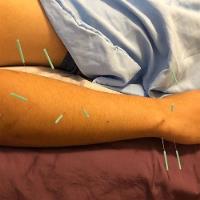 Morningside Acupuncture image 5