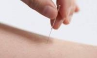 Dr JiMong’s Miracle Acupuncture Alpharetta image 3