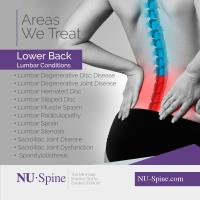 NU-Spine image 3