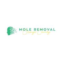 Mole Removal Orange County image 5