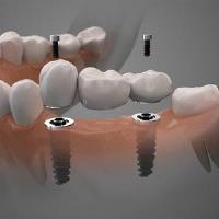 Powers Dental Group image 2