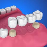 Powers Dental Group image 8