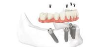 Elite Dentistry image 4