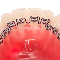 SoCo Smiles Orthodontics image 4
